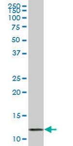 VAMP1 Antibody in Western Blot (WB)