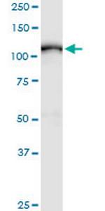 ADAM17 Antibody in Western Blot (WB)