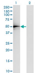 TADA2L Antibody in Western Blot (WB)