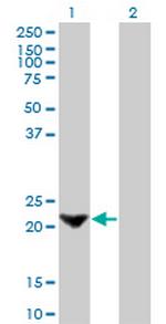 TAGLN Antibody in Western Blot (WB)