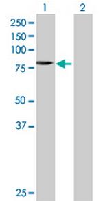 TAF6 Antibody in Western Blot (WB)