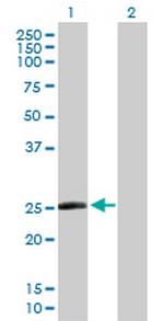 TAF10 Antibody in Western Blot (WB)