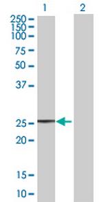 TAF11 Antibody in Western Blot (WB)