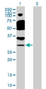 TAF11 Antibody in Western Blot (WB)