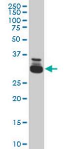 TAF11 Antibody in Western Blot (WB)