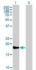 TAF12 Antibody in Western Blot (WB)