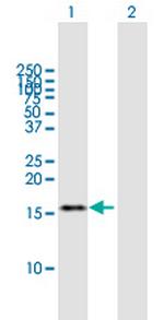 TAF13 Antibody in Western Blot (WB)