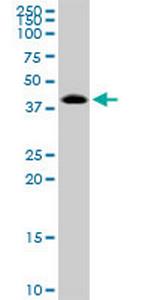 TARBP2 Antibody in Western Blot (WB)