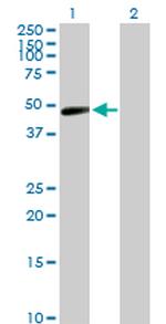 TARBP2 Antibody in Western Blot (WB)