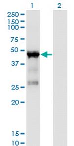 TARBP2 Antibody in Western Blot (WB)