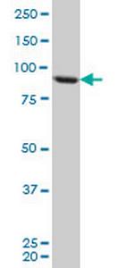 TARS Antibody in Western Blot (WB)