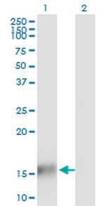 TBCA Antibody in Western Blot (WB)