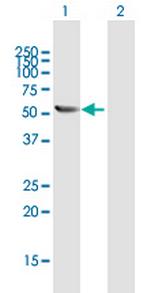 TBCE Antibody in Western Blot (WB)