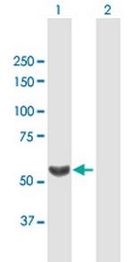 TBL1X Antibody in Western Blot (WB)