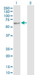 TBL1X Antibody in Western Blot (WB)