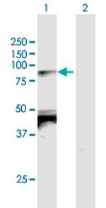 TBX2 Antibody in Western Blot (WB)