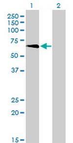 TBX5 Antibody in Western Blot (WB)