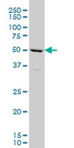 TBX6 Antibody in Western Blot (WB)