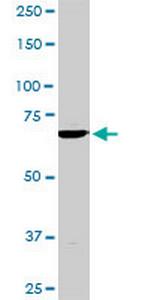 TBX3 Antibody in Western Blot (WB)