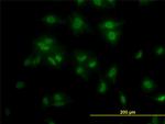 TCF7L2 Antibody in Immunocytochemistry (ICC/IF)