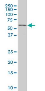 TCF7L2 Antibody in Western Blot (WB)