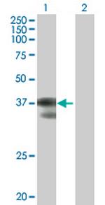 C2orf3 Antibody in Western Blot (WB)