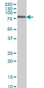 TCF12 Antibody in Western Blot (WB)