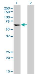 VPS72 Antibody in Western Blot (WB)
