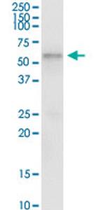 TCN1 Antibody in Immunoprecipitation (IP)