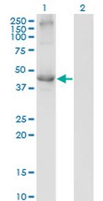 TCN2 Antibody in Western Blot (WB)