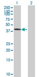 TCP10 Antibody in Western Blot (WB)