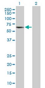 TCP11 Antibody in Western Blot (WB)