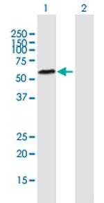 TDG Antibody in Western Blot (WB)