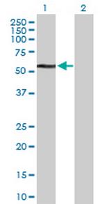 TDG Antibody in Western Blot (WB)