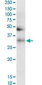 TF Antibody in Western Blot (WB)