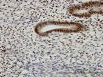 TFAP4 Antibody in Immunohistochemistry (Paraffin) (IHC (P))