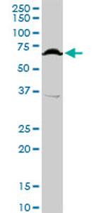 TFCP2 Antibody in Western Blot (WB)