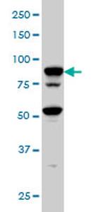 TFRC Antibody in Western Blot (WB)