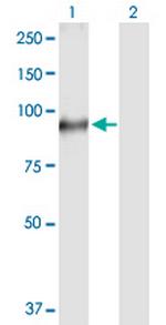 TGM1 Antibody in Western Blot (WB)