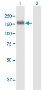 THBS1 Antibody in Western Blot (WB)