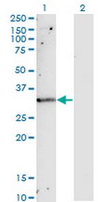 TIMP1 Antibody in Western Blot (WB)