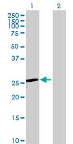 TK1 Antibody in Western Blot (WB)