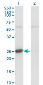 TK1 Antibody in Western Blot (WB)