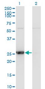 TK1 Antibody in Western Blot (WB)