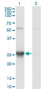 TK1 Antibody in Western Blot (WB)