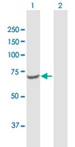 TKT Antibody in Western Blot (WB)