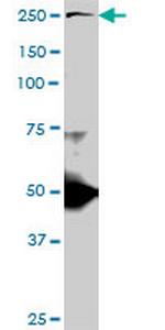 TLN1 Antibody in Western Blot (WB)