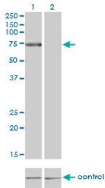 TLR4 Antibody in Western Blot (WB)