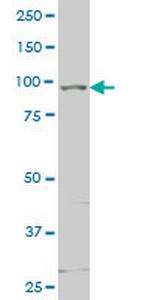 TLR5 Antibody in Western Blot (WB)