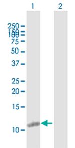 TMSB4X Antibody in Western Blot (WB)